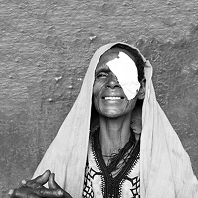 older lady with one eye bandaged